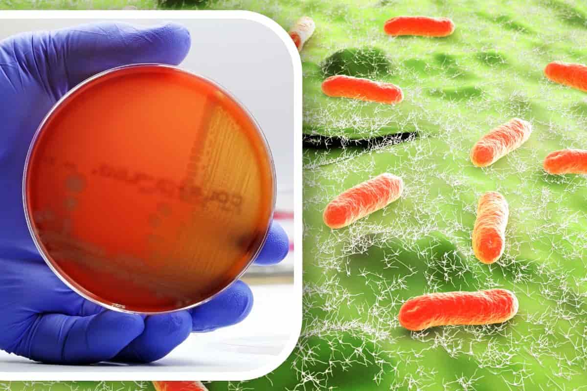 allarme e.coli comune pratica diffonde patogeni